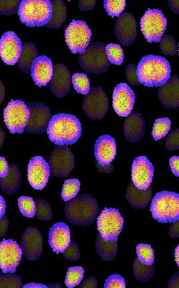 1022279-20180302-1258