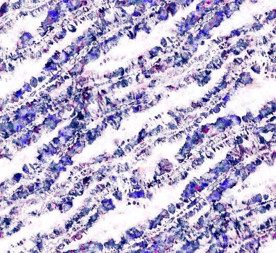 水彩印花华亿平台图片