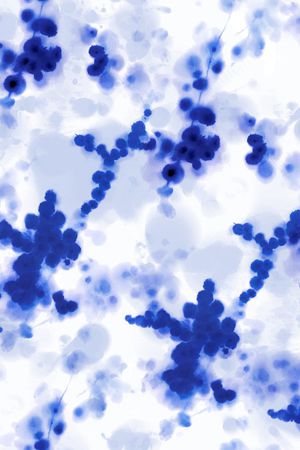 小碎花印花华亿平台图片