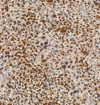 1印花华亿平台图片