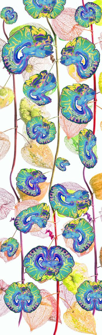 骷髅印花华亿平台图片