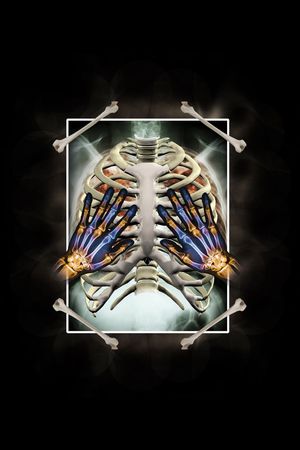 X光片印花华亿平台图片