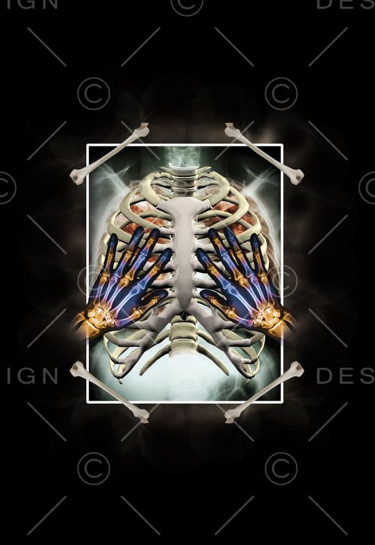 X光片印花华亿平台图片