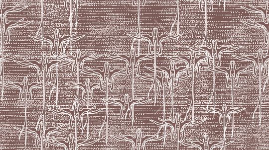 黑白印花华亿平台图片