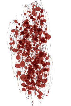 面料急诊--精神分裂症印花华亿平台图片