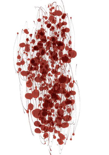 面料急诊--精神分裂症印花华亿平台图片